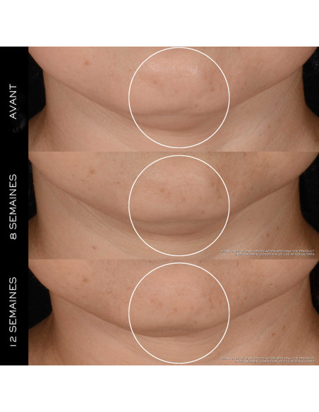 LANCÔME RENERGIE H.P.N. 300-PEPTIDES Type du produit: RECHARGE Crèm...