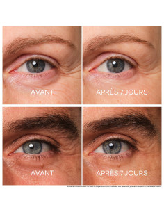 Guerlain Abeille Royale soin yeux réparateur jeunesse anti âge 2