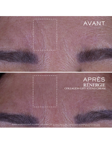 Lancôme Rénergie Crème Anti-âge Lift